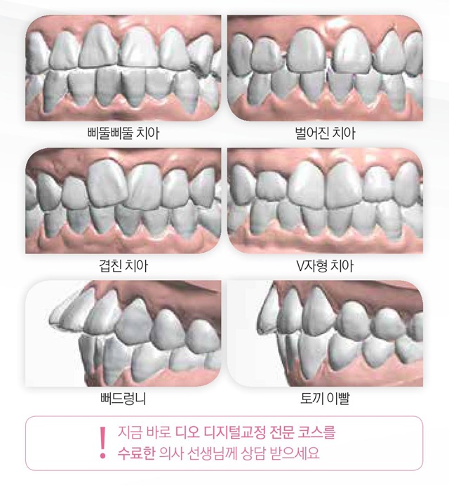 디지털교정이란