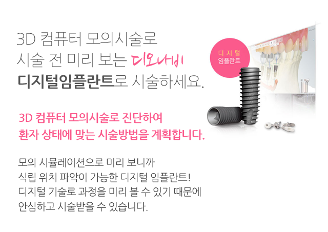디오나비시스템장점